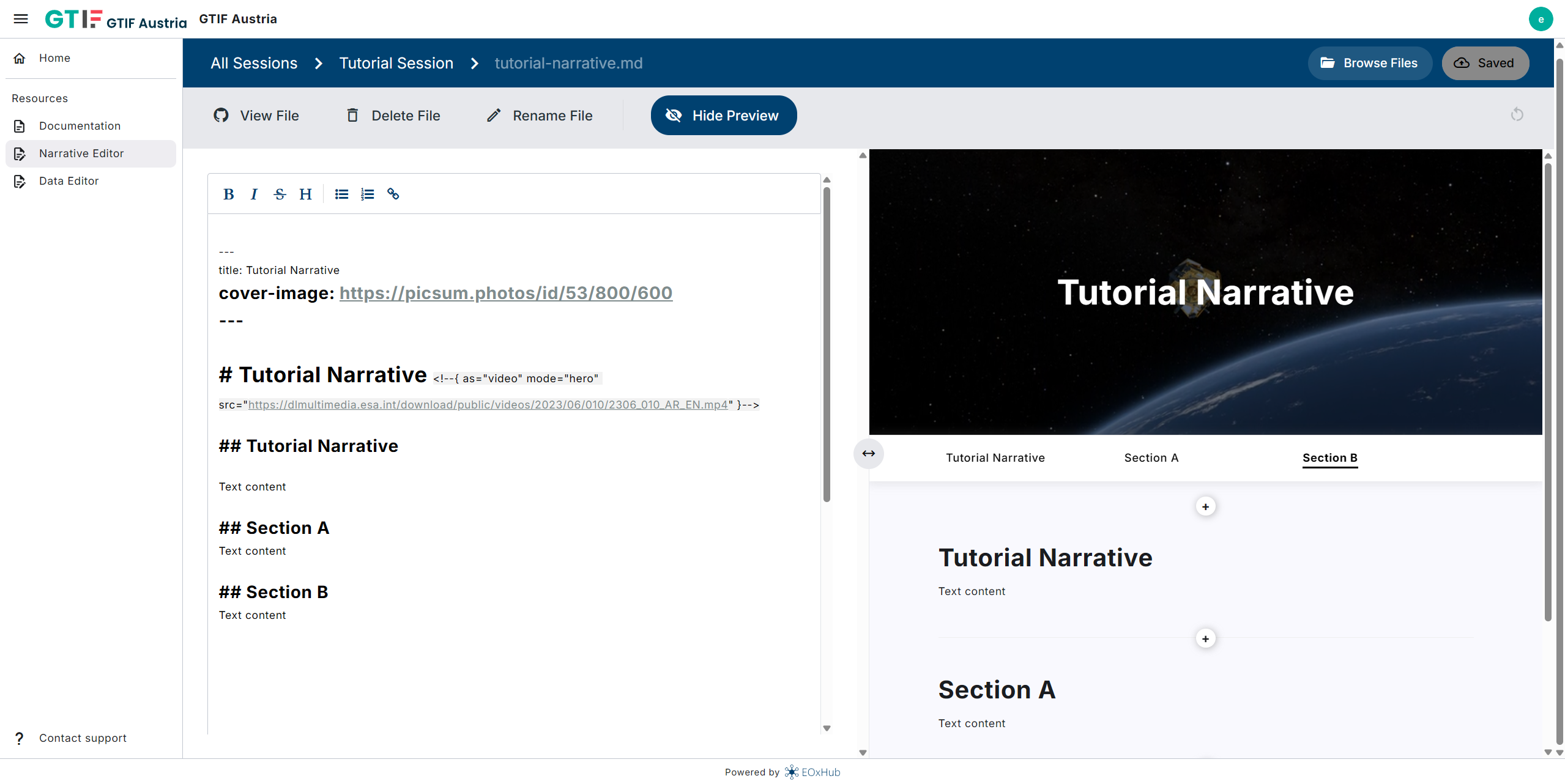 The Narrative Editor interface